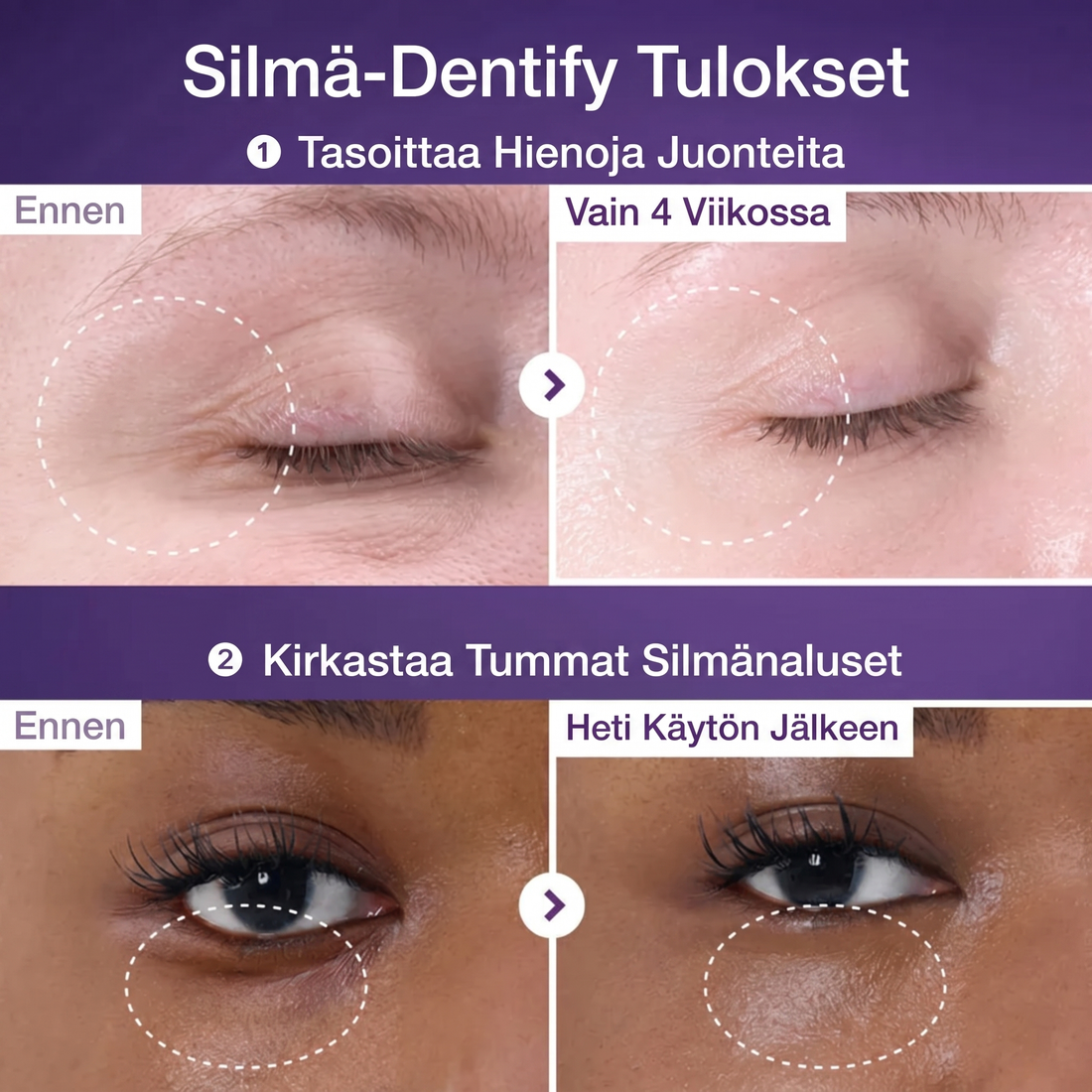 NAD+ Retinol Volumetox Øyekrem – Anti-aging, Fine linjer, Mørke ringer og Hevelser