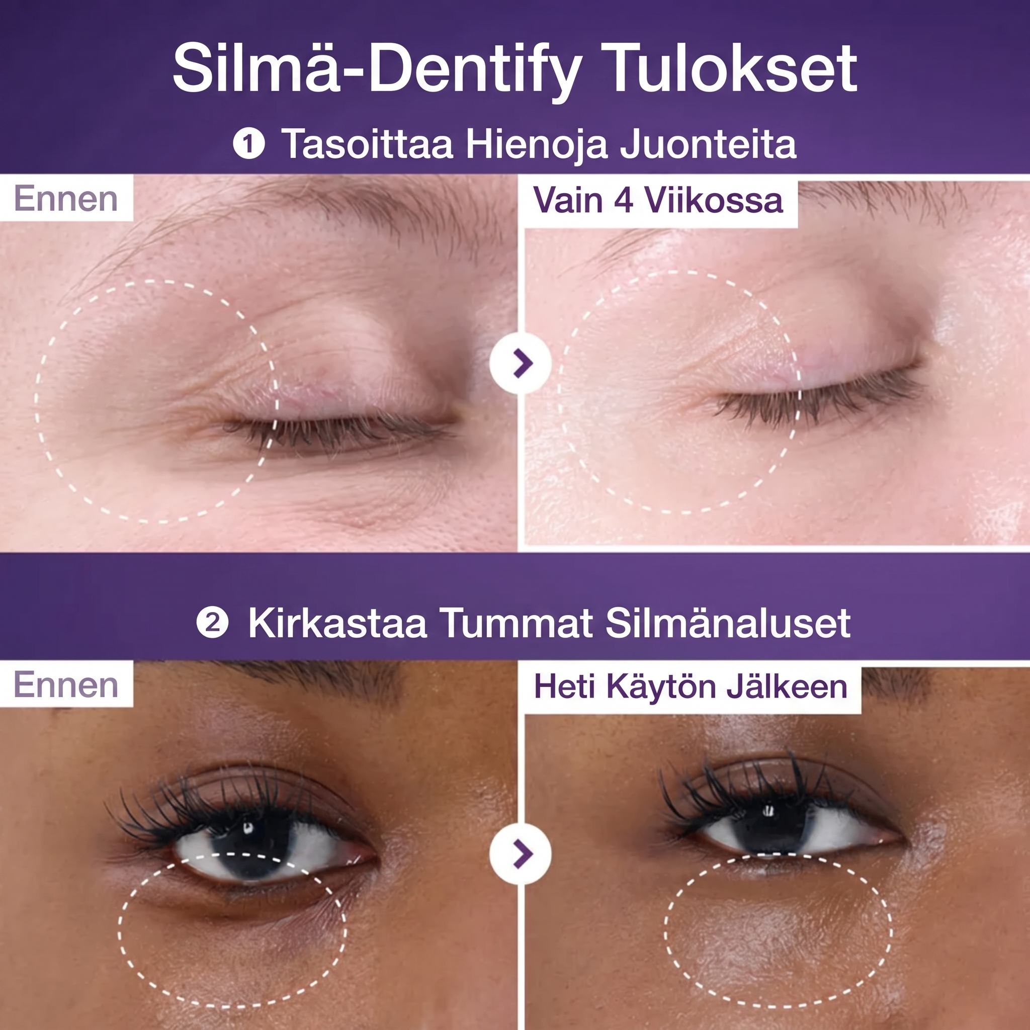 NAD+ Retinol Volumetox Øyekrem – Anti-aging, Fine linjer, Mørke ringer og Hevelser